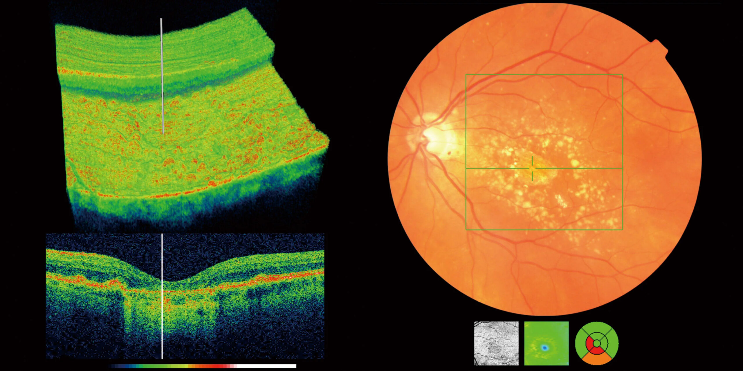 OTC scan | Bognor Regis | West Sussex | 01243 554091